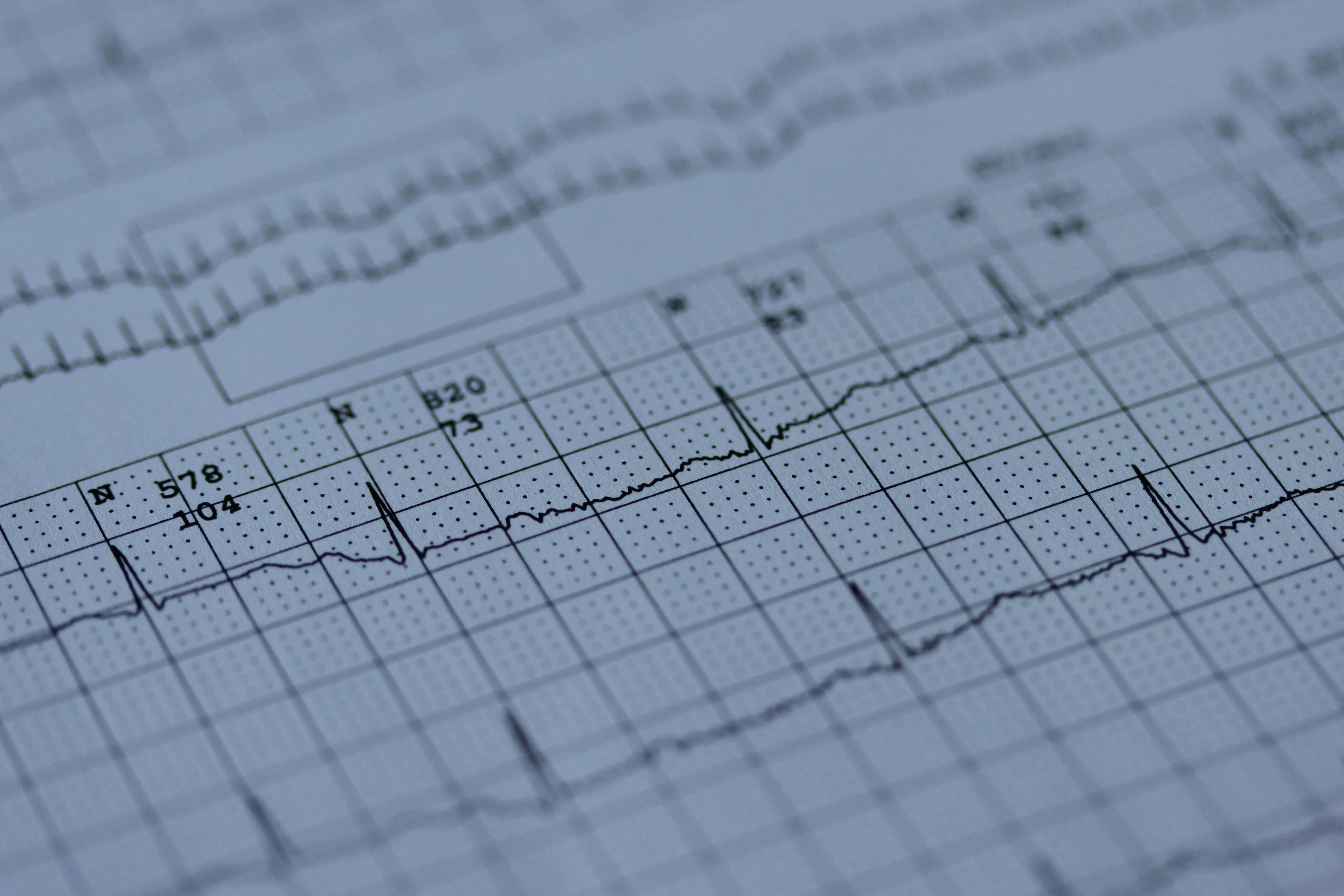 ekg